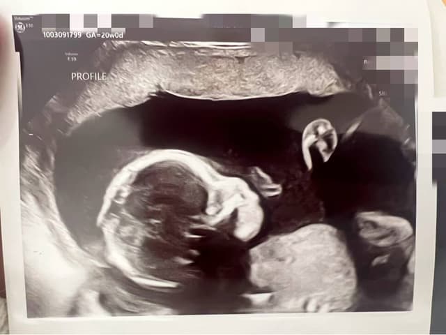 Anatomy scan